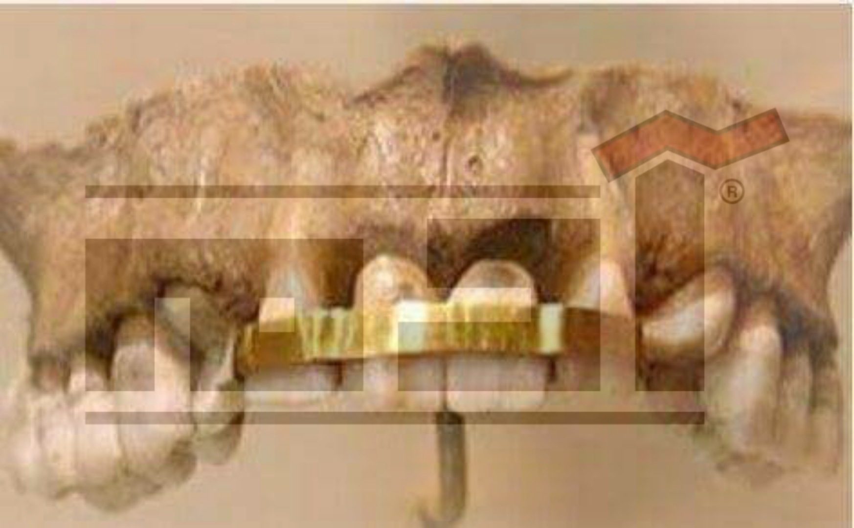 الفراعنة و طب الأسنان .. معجزات فرعونية الجزء الخامس 1 طب الأسنان , قدماء المصريين , الفراعنة , معجزات فرعونية ,