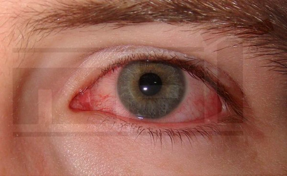 فوائد الدموع للوقاية من جفاف العين 