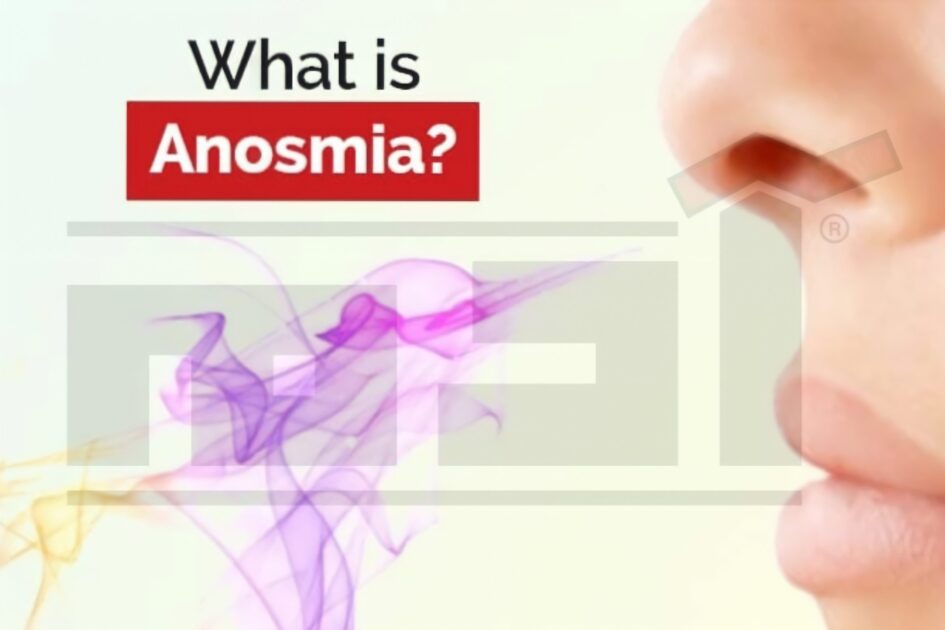 Anosmia scaled