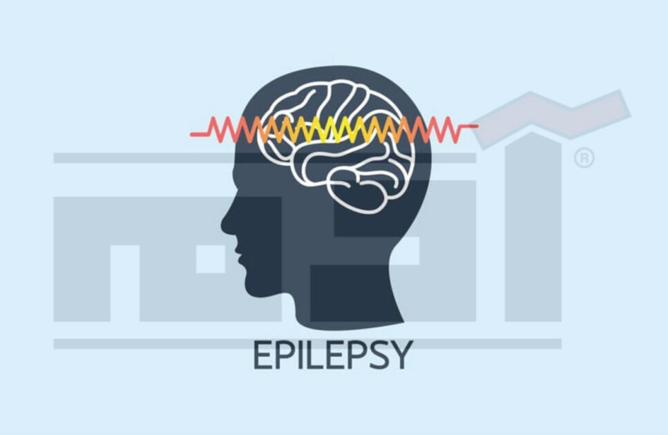 الصرع .. أسبابه وعلاجه وتشخيصه .. هل يمكن توريث الصرع