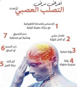 تعرف على مرض الـ MS أو التصلب اللويحي المتعدد وكيفية العلاج بـ3 طرق 4 أعراض التصلب اللويحي المتعدد