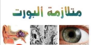 أرثر سيسل ألبورت.. مكتشف متلازمة ألبورت 7 متلازمة ألبورت