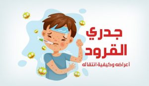 جدري القرود monkeypox أو جدري النسناس.. هل هو الوباء الجديد بعد كورونا؟ 9 أعراض جدري القرود