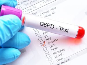 أنيميا الفول.. وما هي أبرز 9 أعراض لها؟ 4 علاج مرض أنيميا الفولG6PD