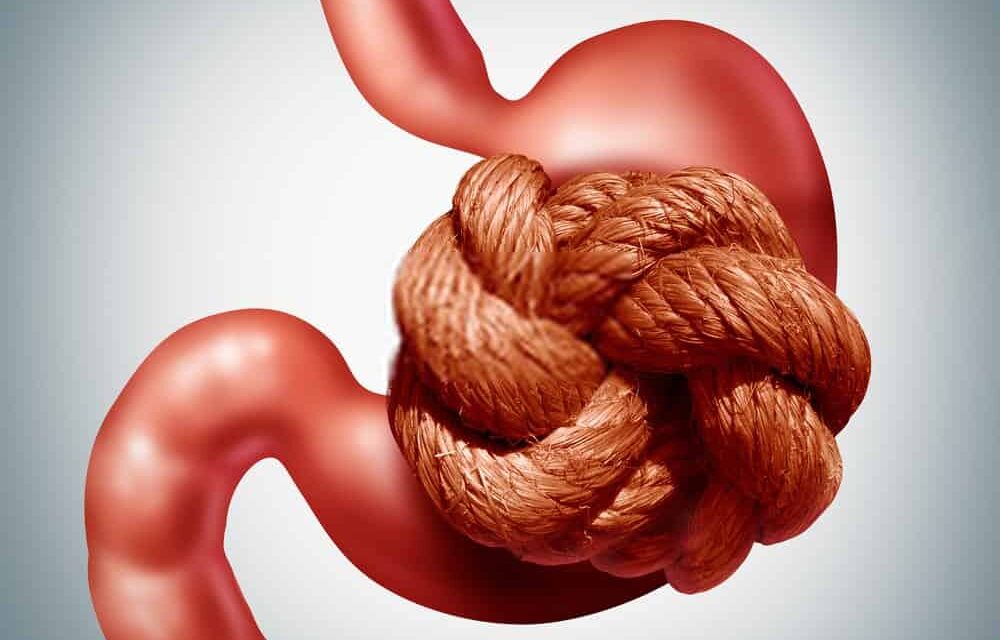 تكميم المعدة.. تعرف على أبرز 12 مخاطر لها