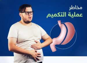 تكميم المعدة.. تعرف على أبرز 12 مخاطر لها 4 مخاطر تكميم المعدة