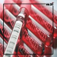 علاج كاسجفي.. أمل جديد لمرضى فقر الدم المنجلي والثلاسيميا 1 علاج كاسجفي لفقر الدم