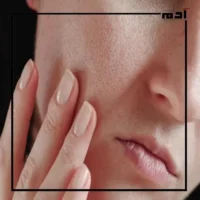 صحتك في خطر.. أبرز أضرار تكييف الهواء على الصحة 3 جفاف الجلد