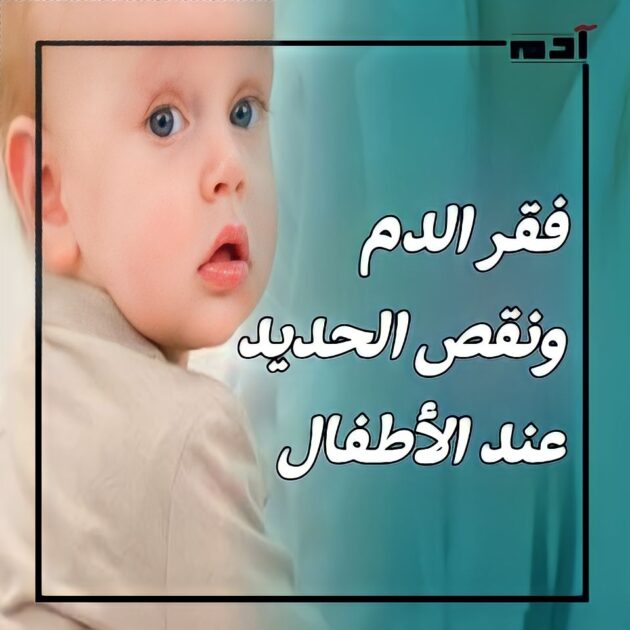 فقر الدم ونقص الحديد عند الأطفال