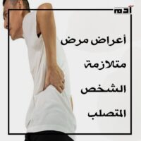 متلازمة الشخص المتصلب.. من الأعراض إلى البحث عن العلاج 2 أعراض مرض متلازمة الشخص المتصلب