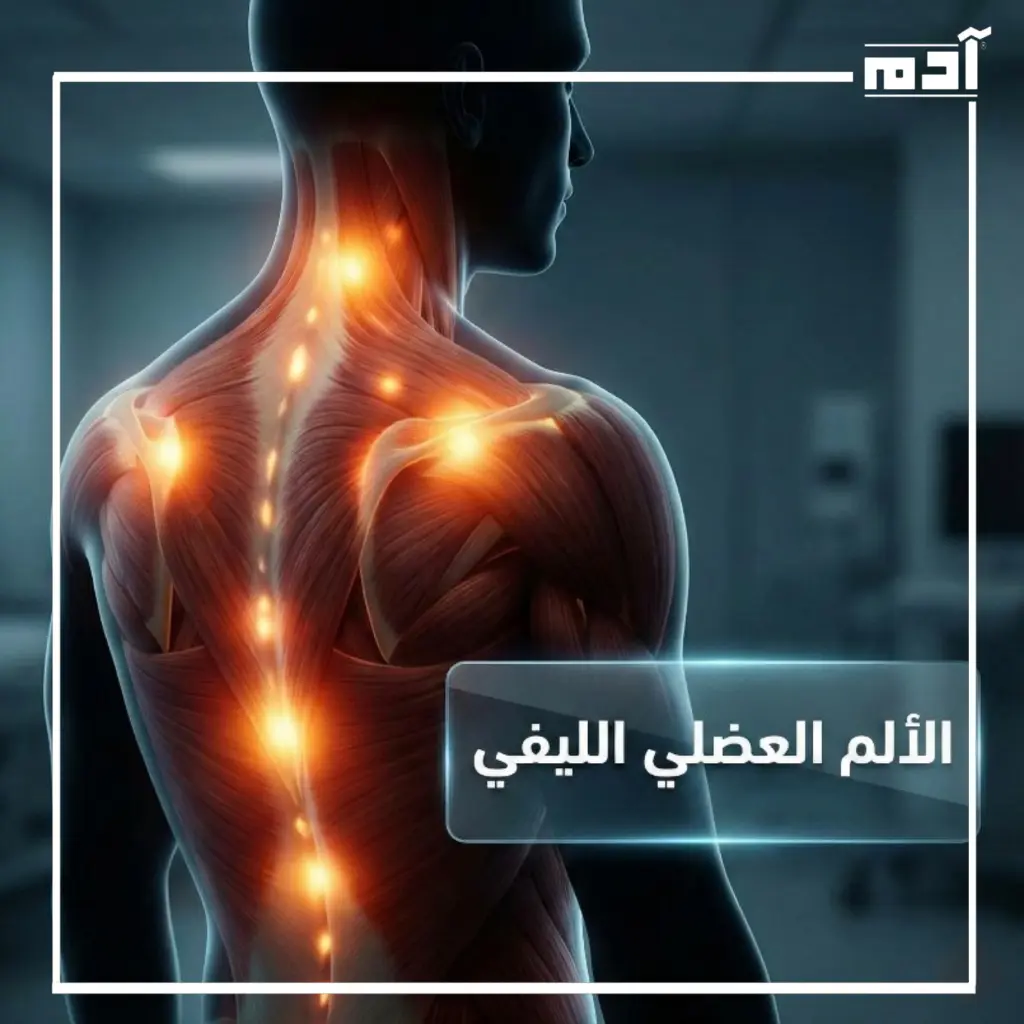 الألم العضلي الليفي