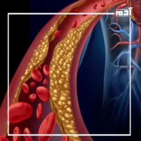 كيفية ضبط الكوليسترول في الدم؟.. حلول عملية وفعالة 1 أسباب عدم ضبط الكوليسترول في الدم