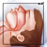 Sleep apnea.. Discover modern scientific treatments 3 Risk of sleep apnea