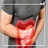 Do you want to treatment IBS?.. Here's the perfect solution 2 Severe IBS symptoms