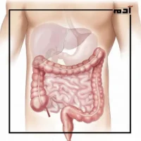 Do you want to treatment IBS?.. Here's the perfect solution 3 Symptoms of IBS in men