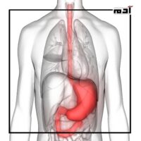 Treatment of gastritis.. How to overcome pain and avoid serious complications 2 The effect of gastritis on the body