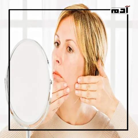 Increased hair hormone in women.. How is it treatment