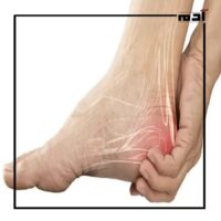 تعرف على سبب وجع كعب الرجل وأعراضه الخطيرة 1 ما سبب وجع كعب الرجل؟