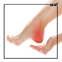 تعرف على سبب وجع كعب الرجل وأعراضه الخطيرة 3 تعريف وجع كعب الرجل