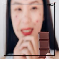 دليلك الشامل للتعامل مع حب الشباب.. من الوقاية إلى العلاج 3 الأطعمة والعادات اليومية.. هل لها دور في ظهور حب الشباب؟