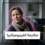 متلازمة الفيبروميالجيا